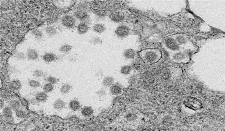 SARS and the New Coronavirus Target the Same Cellular Lock to Infect Cells