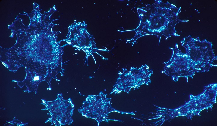 Cancer cells 'remove blindfold' to spread