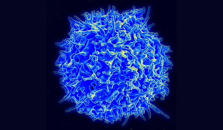 T Cells Recognize Recent SARS-CoV-2 Variants